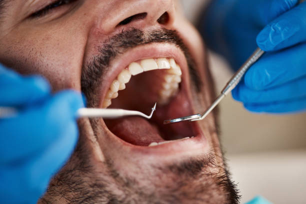 Best Cracked Tooth Emergency Dentist  in Harvey, LA