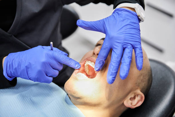 Emergency Gum Pain Relief in LA