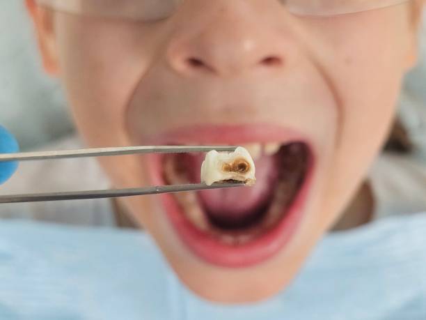 Dentist for Dental Trauma in LA